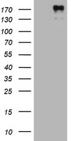 ALK Antibody in Western Blot (WB)