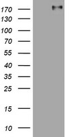 ALK Antibody in Western Blot (WB)