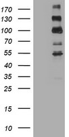ALK Antibody in Western Blot (WB)