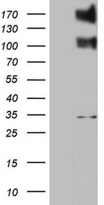 ALK Antibody in Western Blot (WB)