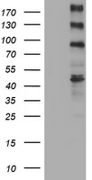 ALK Antibody in Western Blot (WB)