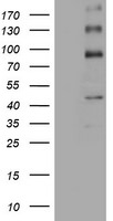ALK Antibody in Western Blot (WB)