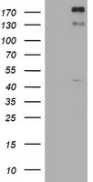 ALK Antibody in Western Blot (WB)