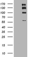 ALK Antibody in Western Blot (WB)