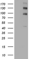 ALK Antibody in Western Blot (WB)