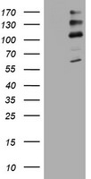 ALK Antibody in Western Blot (WB)