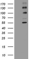 ALK Antibody in Western Blot (WB)