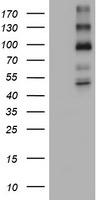 ALK Antibody in Western Blot (WB)
