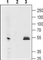 GIRK1 (Kir3.1) (extracellular) Antibody in Western Blot (WB)