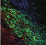 KCNN4 (KCa3.1, SK4) (extracellular) Antibody in Multiplex Immunohistochemistry (mIHC)