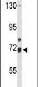 ALOX15B Antibody in Western Blot (WB)