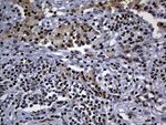 ALOX5 Antibody in Immunohistochemistry (Paraffin) (IHC (P))