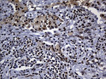 ALOX5 Antibody in Immunohistochemistry (Paraffin) (IHC (P))