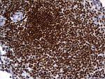 ALOX5 Antibody in Immunohistochemistry (Paraffin) (IHC (P))