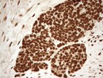 ALOX5 Antibody in Immunohistochemistry (Paraffin) (IHC (P))