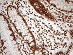 ALOX5 Antibody in Immunohistochemistry (Paraffin) (IHC (P))