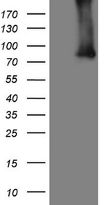 ALOX5 Antibody in Western Blot (WB)