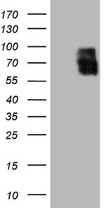 ALPL Antibody in Western Blot (WB)