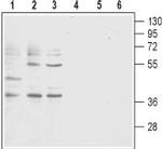 BLT1 (extracellular) Polyclonal Antibody
