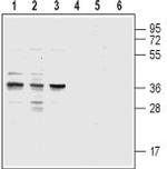 CysLTR1 (extracellular) Polyclonal Antibody