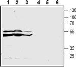 CysLTR2 (extracellular) Polyclonal Antibody