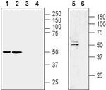 LPAR1 (EDG2) (extracellular) Polyclonal Antibody