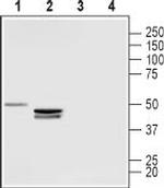 LPAR3 (EDG7) (extracellular) Polyclonal Antibody
