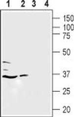 LPAR5 (extracellular) Polyclonal Antibody