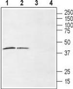 LPAR6 (P2RY5) (extracellular) Polyclonal Antibody