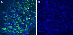 Leptin Receptor (extracellular) Antibody in Immunohistochemistry (Frozen) (IHC (F))