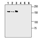 Leptin Receptor (extracellular) Antibody in Western Blot (WB)