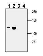 Leptin Receptor (extracellular) Antibody in Western Blot (WB)