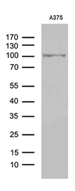 ALS2CR11 Antibody in Western Blot (WB)