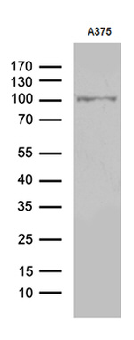 ALS2CR11 Antibody in Western Blot (WB)