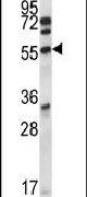 PFTK2 Antibody in Western Blot (WB)