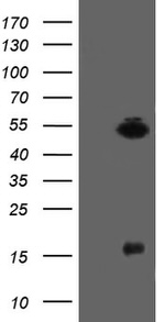 ALX4 Antibody in Western Blot (WB)