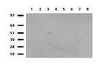 ALX4 Antibody in Western Blot (WB)