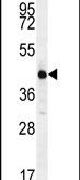 ALX4 Antibody in Western Blot (WB)