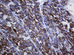 AMACR Antibody in Immunohistochemistry (Paraffin) (IHC (P))