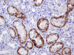 AMACR Antibody in Immunohistochemistry (Paraffin) (IHC (P))