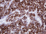 AMACR Antibody in Immunohistochemistry (Paraffin) (IHC (P))