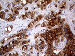 AMACR Antibody in Immunohistochemistry (Paraffin) (IHC (P))