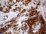 AMACR Antibody in Immunohistochemistry (Paraffin) (IHC (P))