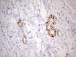 AMACR Antibody in Immunohistochemistry (Paraffin) (IHC (P))