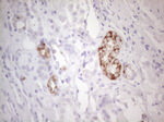 AMACR Antibody in Immunohistochemistry (Paraffin) (IHC (P))