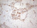 AMACR Antibody in Immunohistochemistry (Paraffin) (IHC (P))
