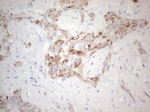 AMACR Antibody in Immunohistochemistry (Paraffin) (IHC (P))