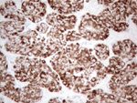 AMACR Antibody in Immunohistochemistry (Paraffin) (IHC (P))