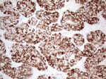 AMACR Antibody in Immunohistochemistry (Paraffin) (IHC (P))
