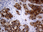 AMACR Antibody in Immunohistochemistry (Paraffin) (IHC (P))